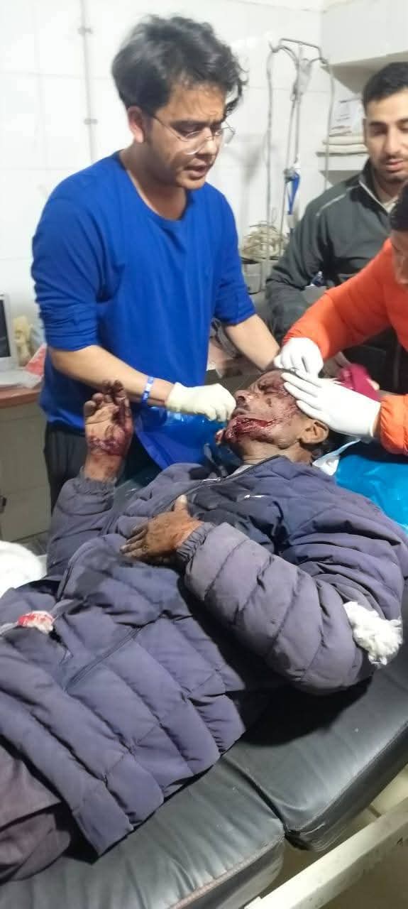 In this village council of Rudraprayag, a 55-year-old man was seriously injured in a bear attack; this is the number of people who have been injured in such attacks in the last 25 years.